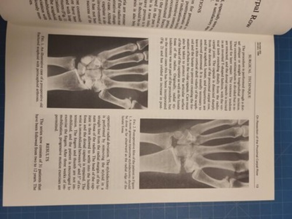 Clinical Orthopaedics Related Research Journal Number 202 January 1986 Book - Picture 7 of 7